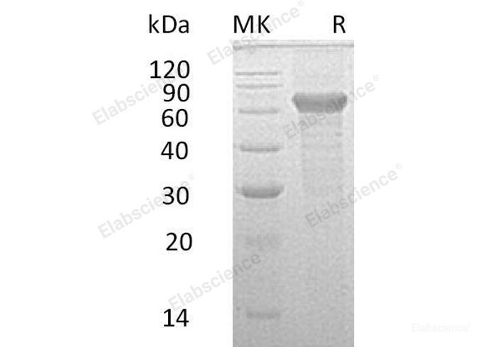 Recombinant Human IL-20 receptor subunit beta/IL-20RB Protein(C-Fc)-Elabscience