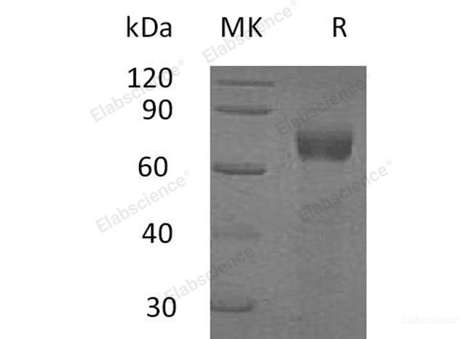 Recombinant Human IL-20 Receptor Subunit α α/IL20RA Protein(C-Fc)-Elabscience
