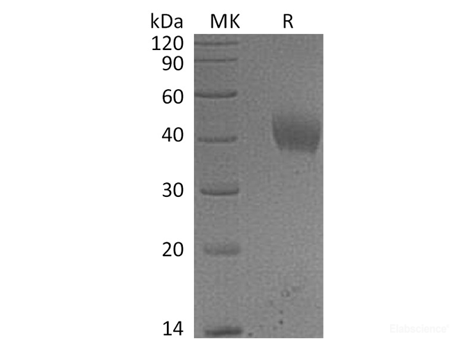 Recombinant Human IL-20 Receptor Subunit α/IL20RA Protein(C-6His)-Elabscience
