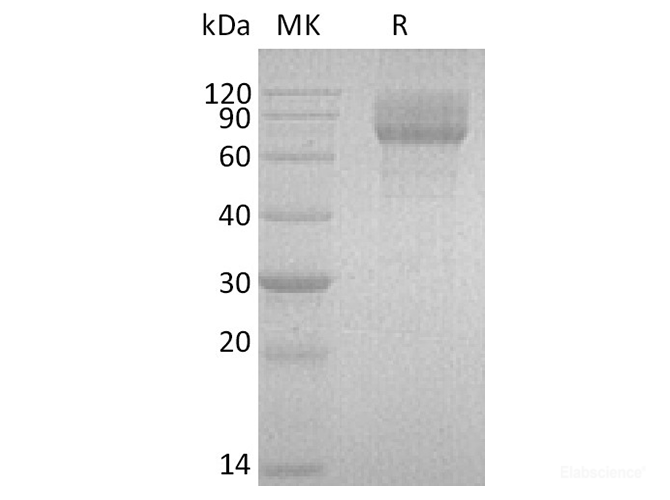 Recombinant Human IL-22 Receptor Subunit α2/IL-22BP/IL-22RA2 Protein(C-Fc)-Elabscience