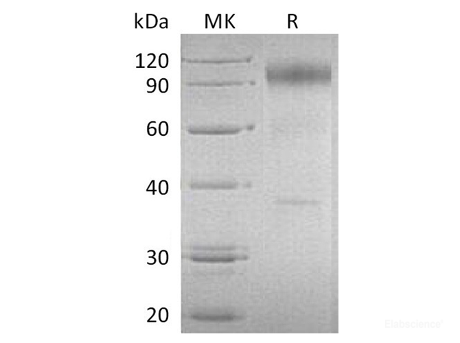 Recombinant Human IL-23 Recetor/IL-23R Protein(C-Fc)-Elabscience