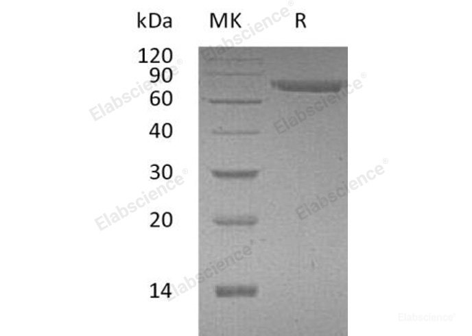 Recombinant Human Immunoglobulin Superfamily Member 8/IGSF8/CD316 Protein(C-6His)-Elabscience