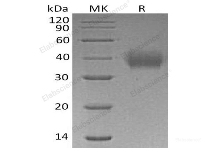 Recombinant Human Immunoglobulin α Fc Receptor/FCAR/CD89 Protein(C-6His)-Elabscience