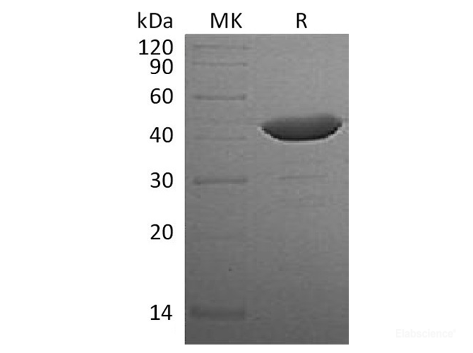 Recombinant Human Indoleamine 2,3-Dioxygenase/IDO/INDO Protein(N-6His)-Elabscience