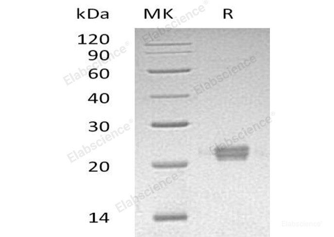 Recombinant Human Inosine Triphosphate Pyrophosphatase/ITPase Protein(C-6His)-Elabscience