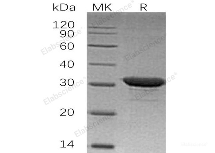 Recombinant Human Inositol Monophosphatase 1/IMPA1/IIMPase 2 Protein(N-6His)-Elabscience
