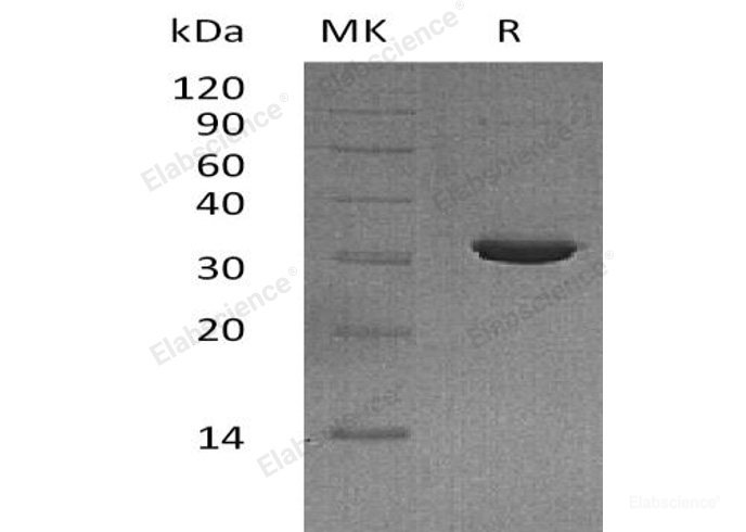 Recombinant Human Inositol Monophosphatase 2/IMPase 2 Protein(N-6His)-Elabscience