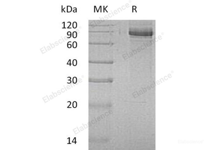 Recombinant Human Inositol Polyphosphate 1-Phosphatase/INPP1 Protein(C-6His)-Elabscience