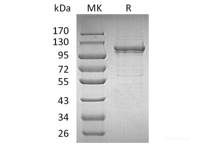 Recombinant Human Insulin-Degrading Enzyme/IDE/Insulysin Protein(C-6His)-Elabscience