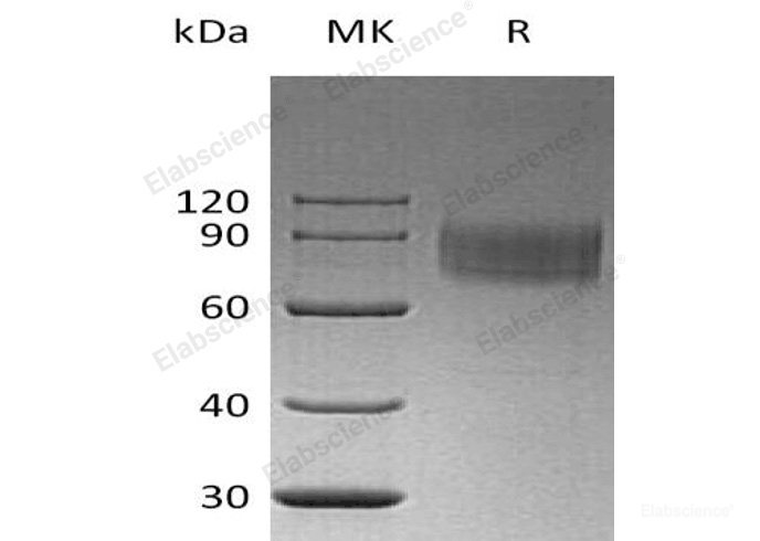 Recombinant Human Interferon α/β Receptor 1/IFNAR1 Protein(C-6His)-Elabscience