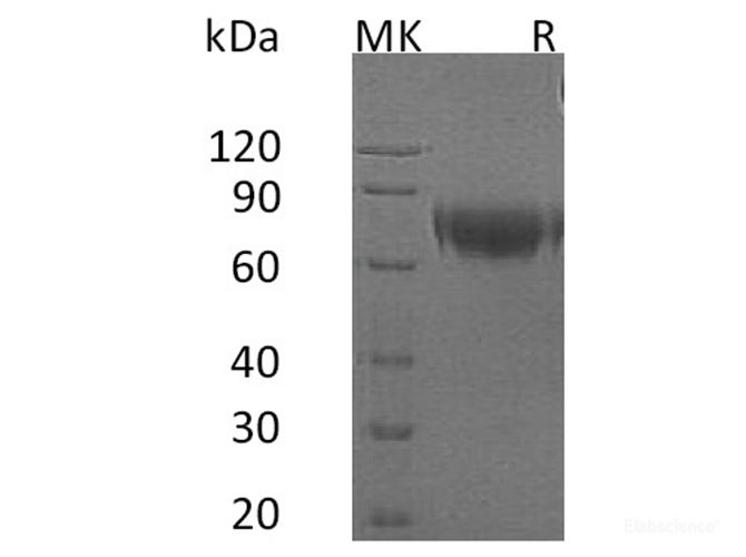 Recombinant Human Interferon α/β Receptor 2/IFNAR2 Protein(C-Fc)-Elabscience