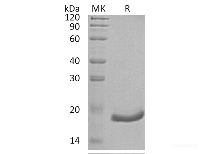 Recombinant Human Interferon α-6/IFNA6 Protein(C-6His)-Elabscience