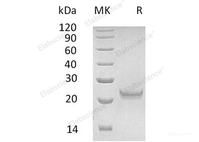 Recombinant Human Interferon ω-1/IFNW1 Protein(C-6His)-Elabscience
