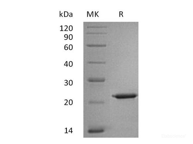 Recombinant Human Interleukin-18/IL-18/IL-1F4 Protein(C-6His)-Elabscience
