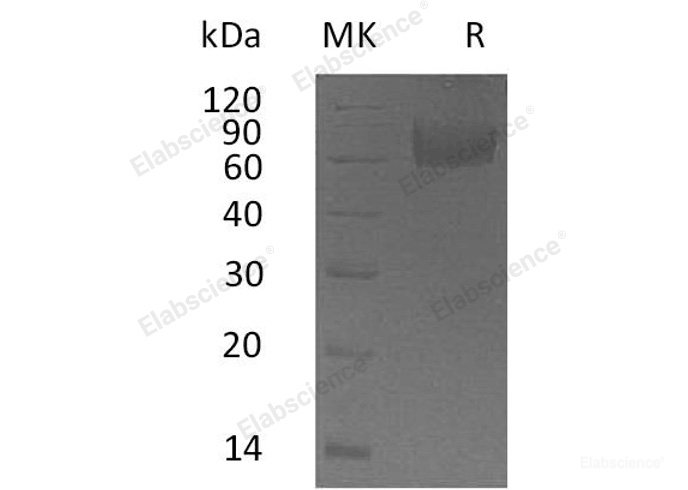 Recombinant Human Interleukin-18-Binding Protein/IL18BP Protein(C-Fc)-Elabscience