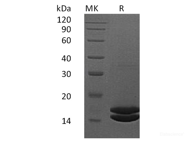 Recombinant Human Interleukin-2/IL-2 Protein(C-6His)-Elabscience