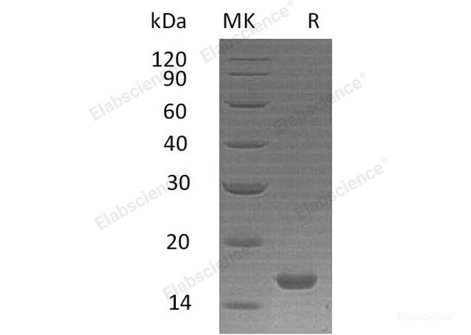 Recombinant Human Interleukin-21/IL-21 Protein-Elabscience