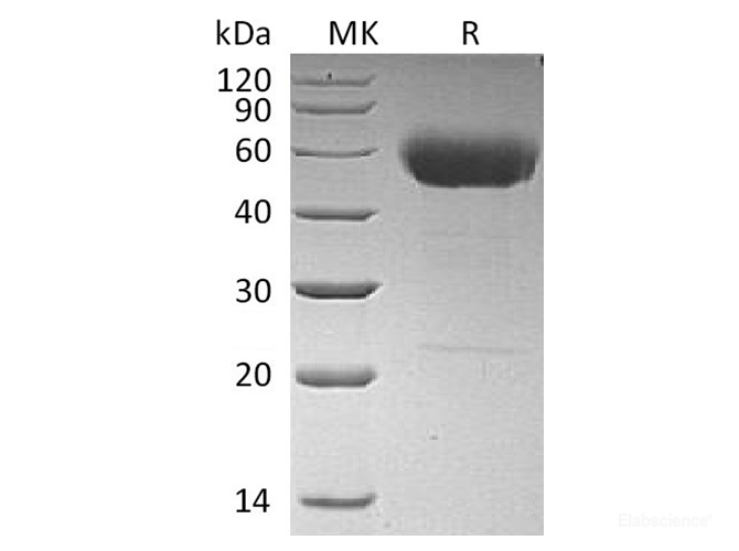 Recombinant Human Interleukin-22/IL-22 Protein(C-hIgG2 Fc)-Elabscience