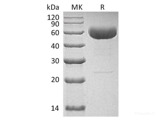 Recombinant Human Interleukin-22/IL-22 Protein(C-hIgG4 Fc)-Elabscience