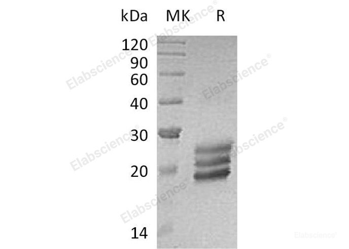 Recombinant Human Interleukin-25/IL-25 Protein(C-6His)-Elabscience