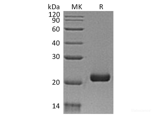 Recombinant Human Interleukin-28B/IL-28B/IFN-lambda 3 Protein(C-6His)-Elabscience