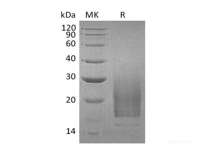 Recombinant Human Interleukin-3/IL-3 Protein(C-6His)-Elabscience