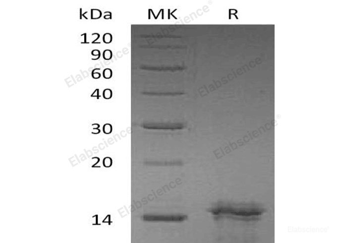 Recombinant Human Interleukin-31/IL-31 Protein-Elabscience
