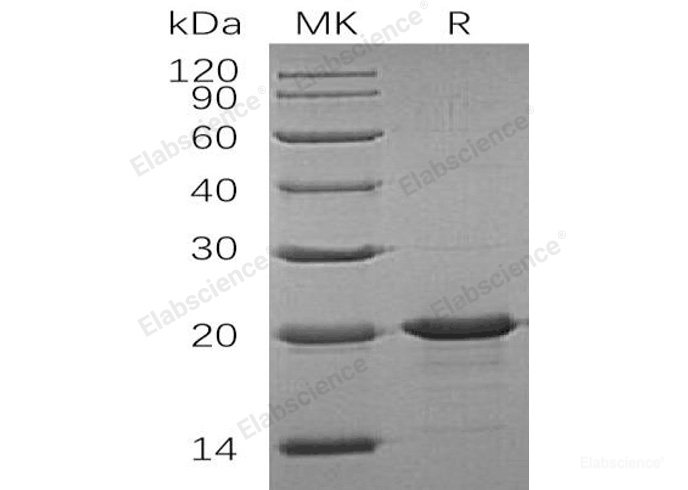 Recombinant Human Interleukin-33/IL-33 Protein(N-6His)-Elabscience