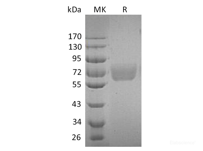 Recombinant Human Interleukin-4 Receptor Subunit Alpha/IL-4 Rα Protein(C-Fc)-Elabscience