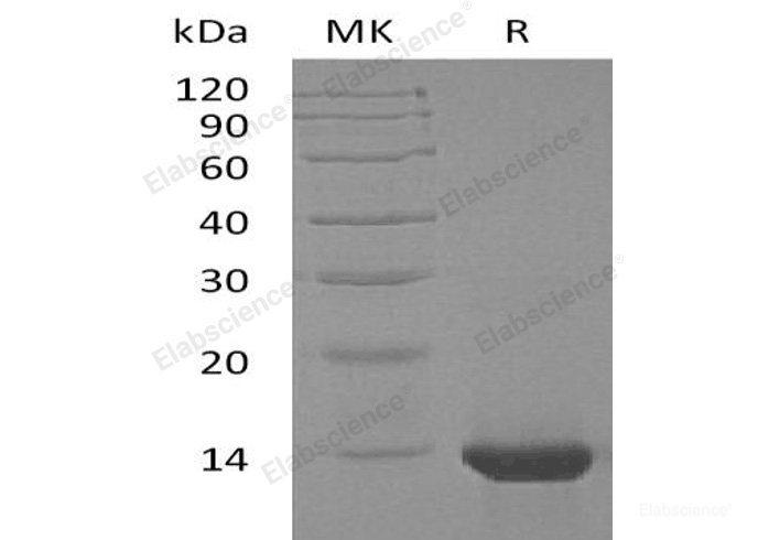 Recombinant Human Interleukin-4/IL-4 Protein-Elabscience