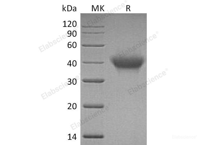 Recombinant Human Interleukin-5 Receptor Subunit Alpha/IL-5 Rα Protein(C-6His)-Elabscience