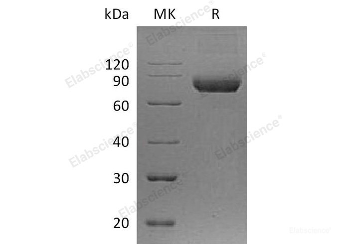 Recombinant Human Interleukin-5 Receptor Subunit Alpha/IL-5 Rα Protein(C-Fc)-Elabscience