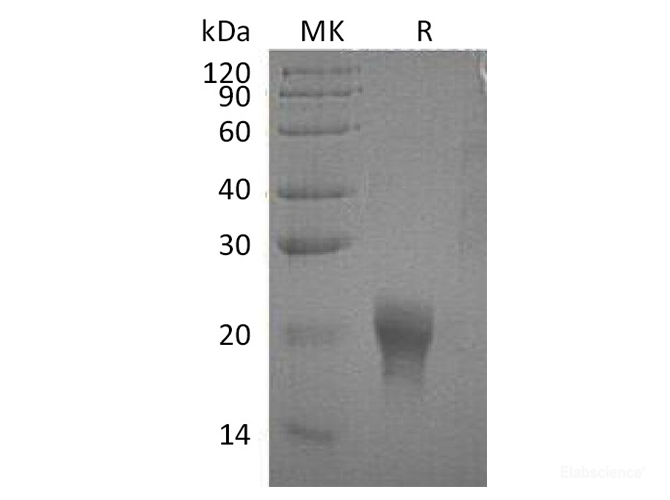 Recombinant Human Interleukin-5/IL-5 Protein(C-6His)-Elabscience