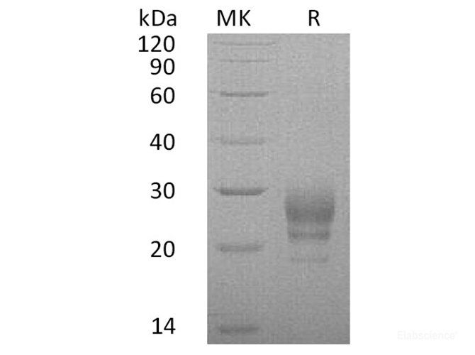 Recombinant Human Interleukin-7/IL-7 Protein(C-6His)-Elabscience