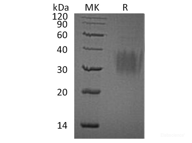 Recombinant Human Interleukin-9/IL-9/Cytokine P40 Protein(C-6His)-Elabscience