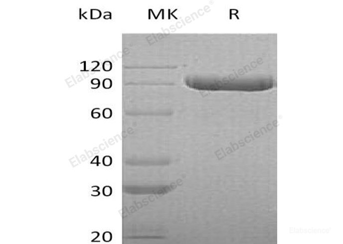Recombinant Human Inter-α-Trypsin Inhibitor Heavy Chain H3/ITIH3 Protein(C-6His)-Elabscience