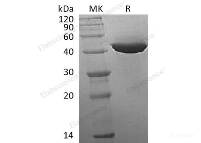 Recombinant Human Isocitrate Dehydrogenase 1/IDH1 Protein(C-8His)-Elabscience