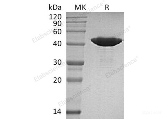Recombinant Human Isocitrate Dehydrogenase 1/IDH1 Protein(R132H, C-8His)-Elabscience