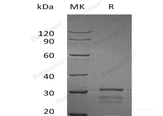 Recombinant Human Isopentenyl Pyrophosphate Isomerase 2//IPPI2/IDI2 Protein(N-6His)-Elabscience