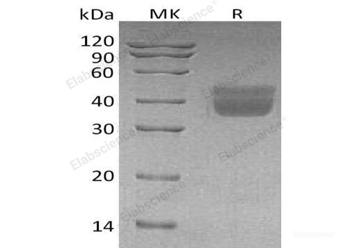 Recombinant Human Kallikrein 1/KLK1 Protein(C-6His)-Elabscience