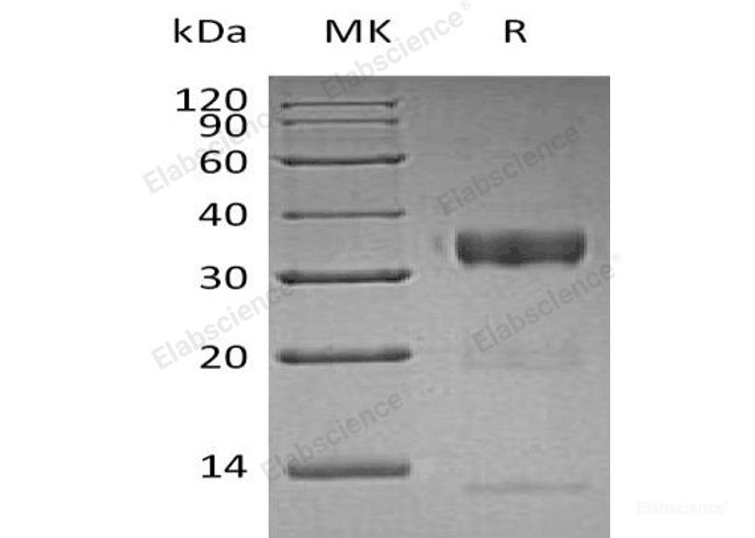 Recombinant Human Kallikrein 10/KLK10 Protein(C-6His)-Elabscience