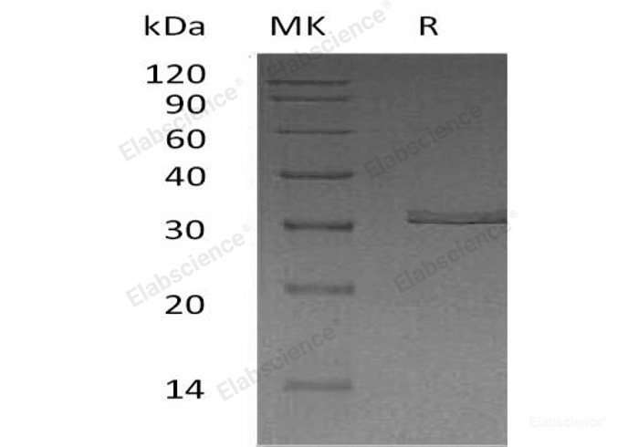 Recombinant Human Kallikrein 2/KLK2 Protein(C-6His)-Elabscience