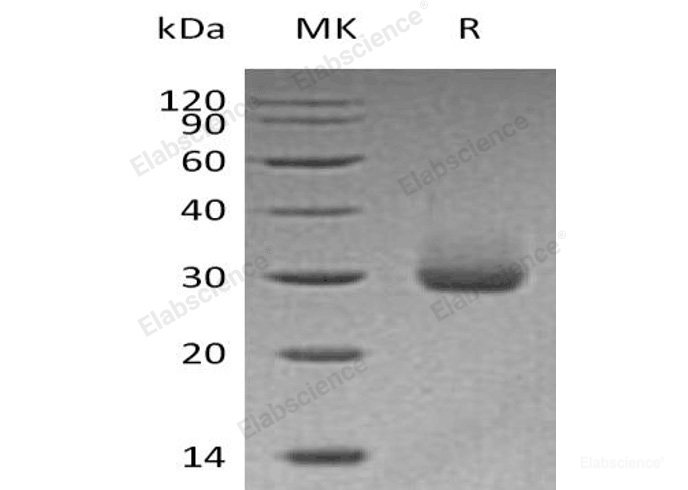 Recombinant Human Kallikrein 4/KLK4 Protein(C-6His)-Elabscience