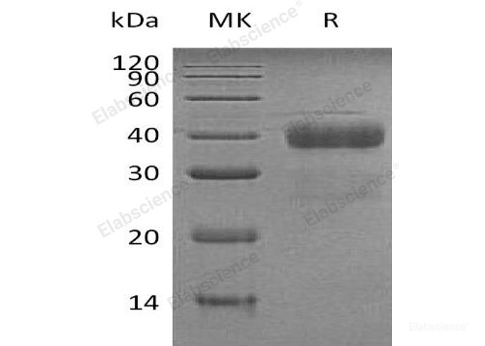 Recombinant Human Kallikrein 5/KLK5 Protein(C-6His)-Elabscience