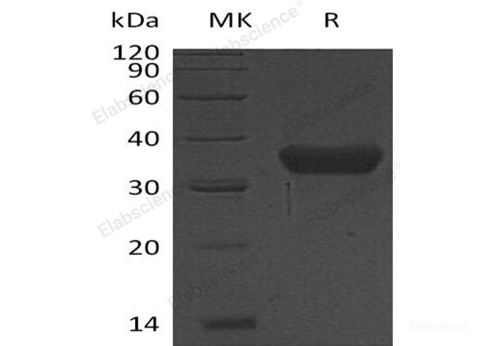 Recombinant Human Kallikrein 8/Neuropsin Protein(C-6His)-Elabscience