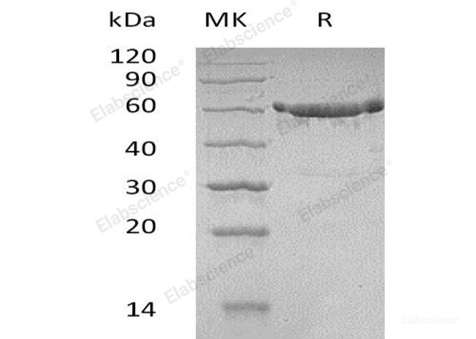 Recombinant Human Karyopherin Subunit α-2 /KPNA2/IPOA1 Protein(N-6His)-Elabscience