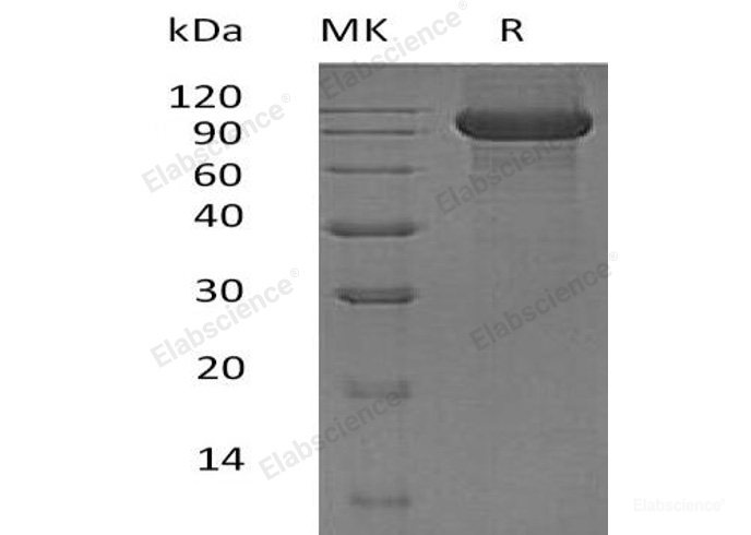 Recombinant Human Kelch-Like protein 41/Kell/CD238 Protein(C-6His)-Elabscience