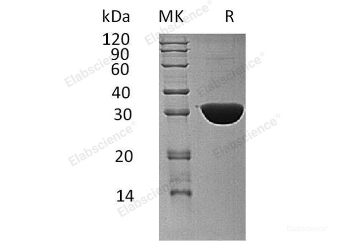 Recombinant Human Ketohexokinase/KHK Protein(C-6His)-Elabscience
