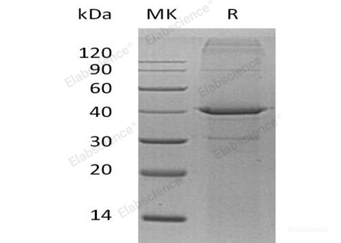 Recombinant Human Kidney-Type Arginase/ARG2 Protein(N-6His)-Elabscience