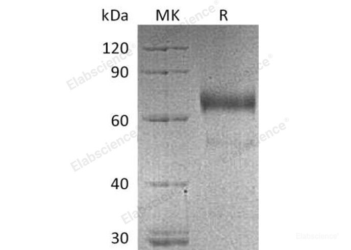 Recombinant Human KIR2DL3/NKAT2/CD158b2 Protein(C-Fc)-Elabscience